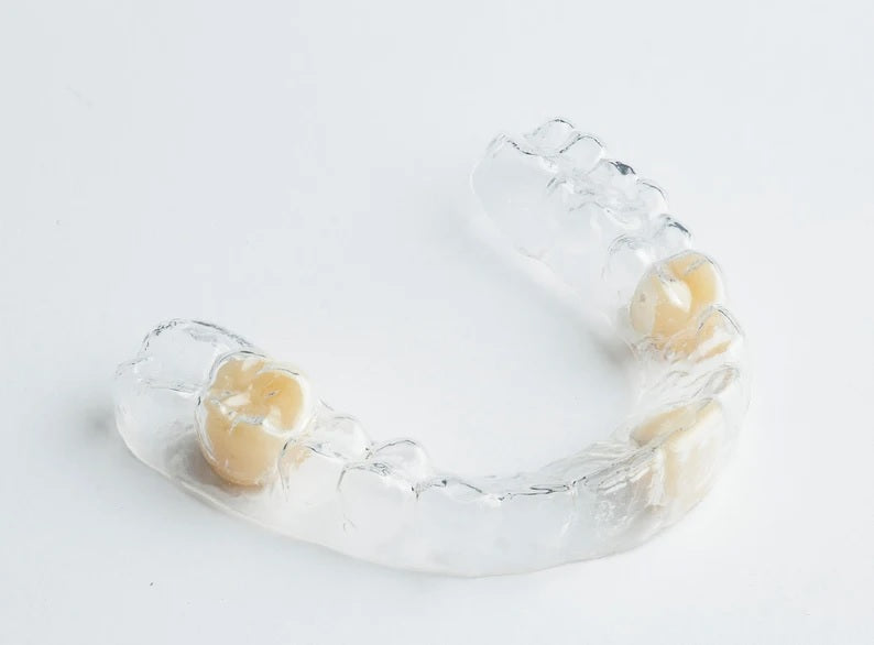 Clear Essix Pontic Retainer Digital Dental Prosthetics