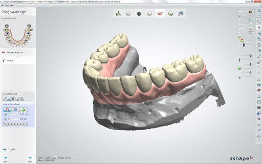 Digital Denture Design Service – Digital Dental Prosthetics